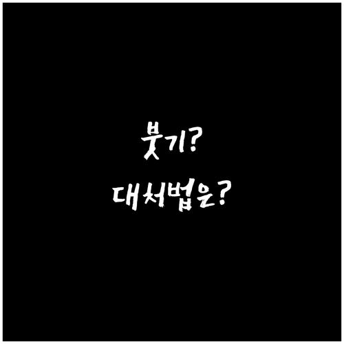 종아리 보톡스 부작용 완벽 분석 후기와 대처법