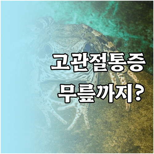 고관절과 무릎 통증의 상호작용과 치료 방향